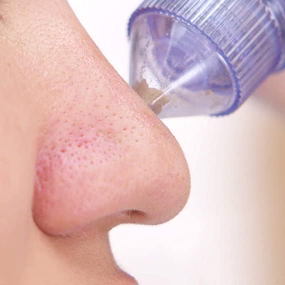Professional 4-in-1 Pore Extraction System